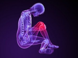 Aarti Shah McTimoney Chiropractor celebrates 25 years in practice with a torn meniscus!!